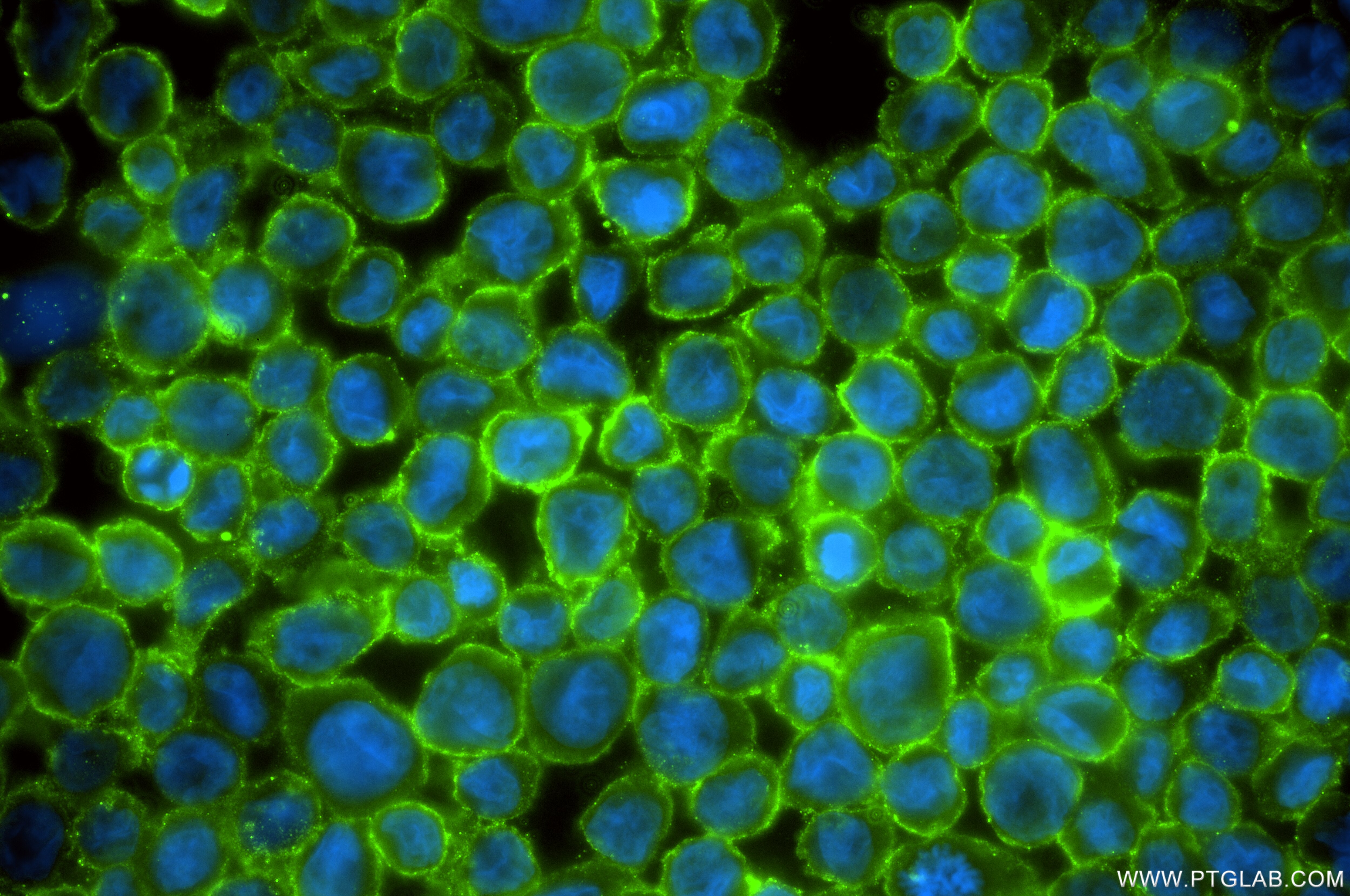 Immunofluorescence (IF) / fluorescent staining of THP-1 cells using C19orf59 Recombinant antibody (86266-1-RR)