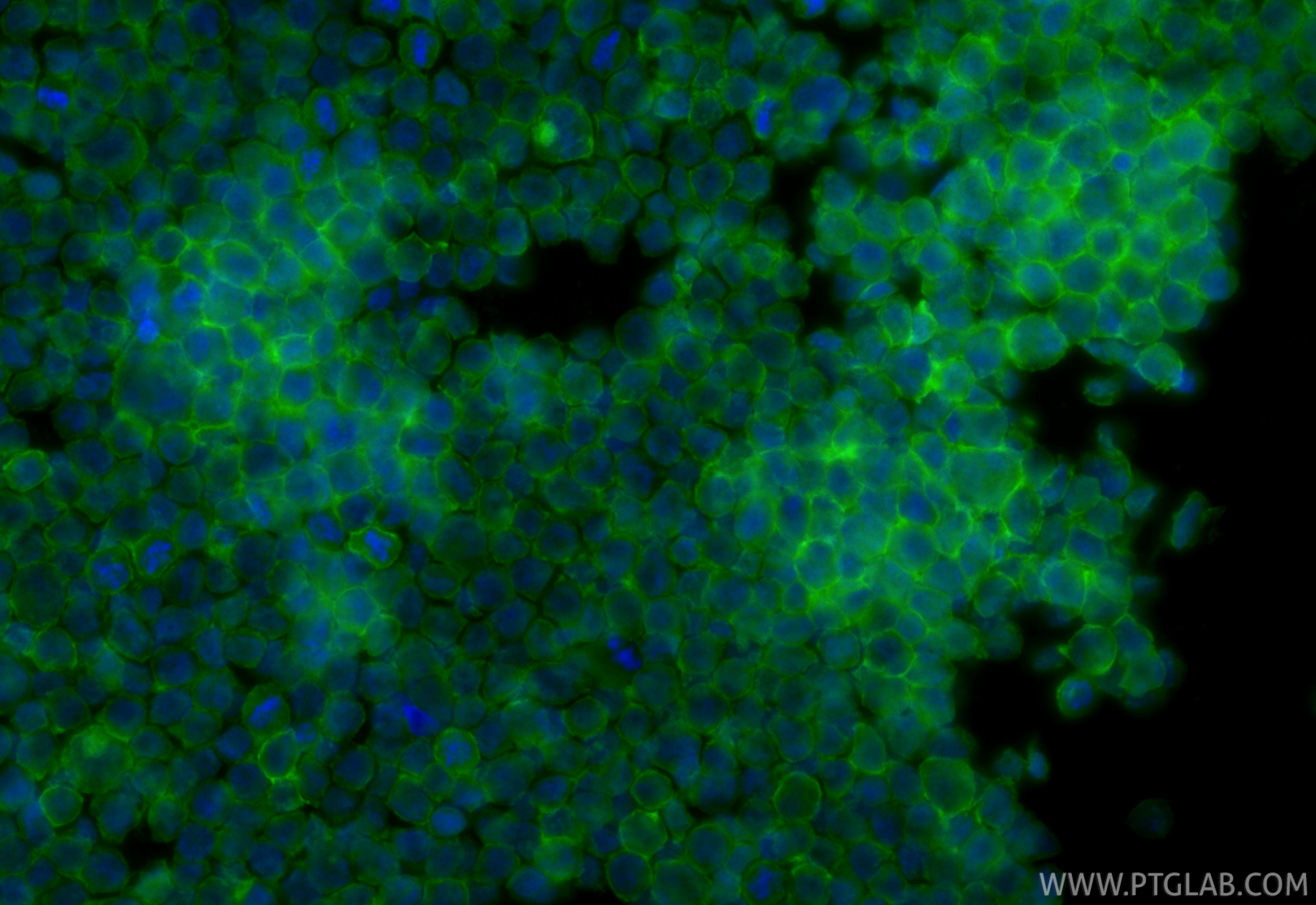 Immunofluorescence (IF) / fluorescent staining of THP-1 cells using CoraLite® Plus 488-conjugated C19orf59 Recombinant (CL488-86266)