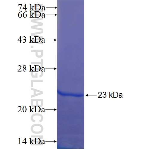 C19orf59 fusion protein Ag22616 SDS-PAGE