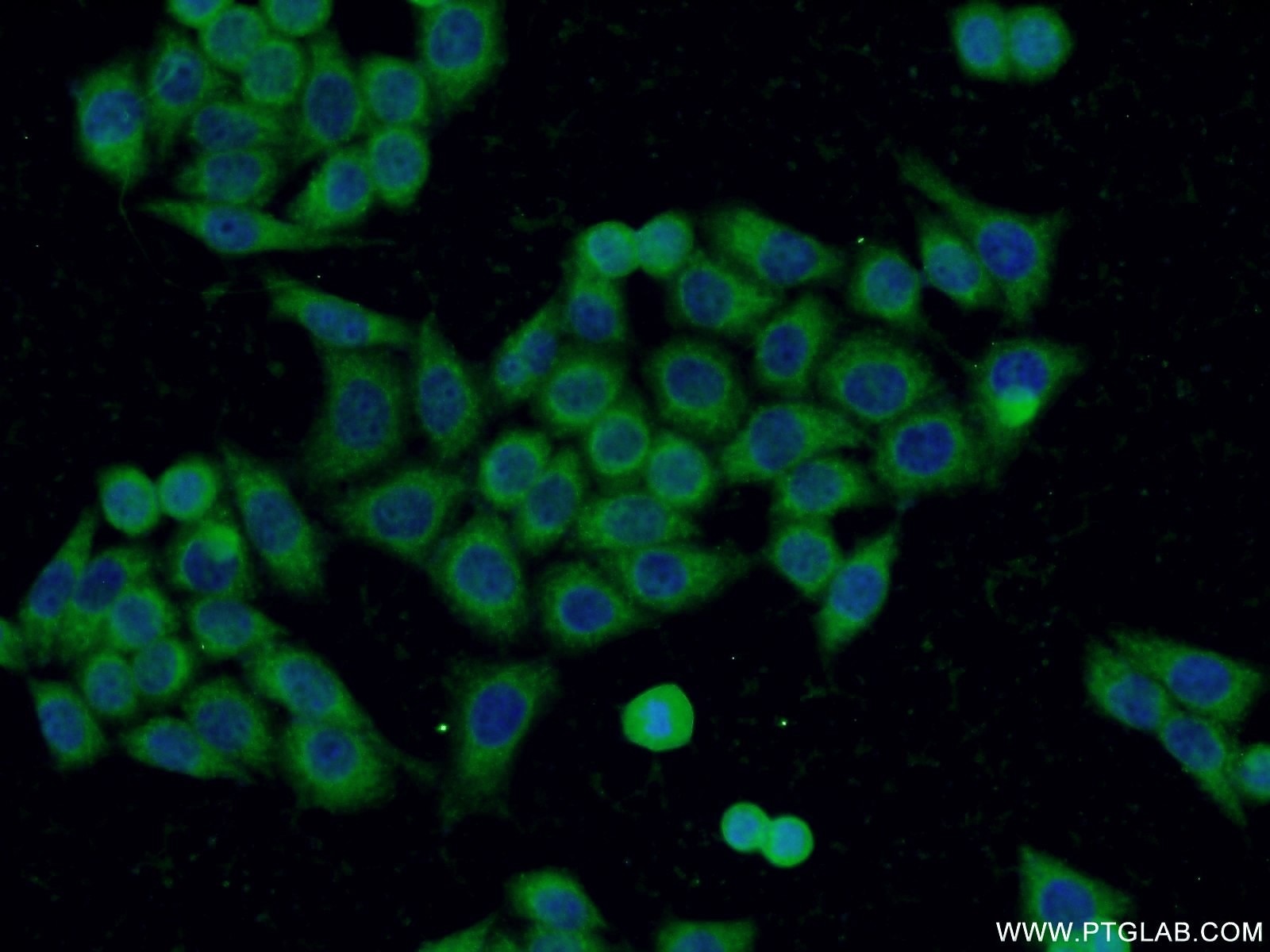 Immunofluorescence (IF) / fluorescent staining of HeLa cells using C19orf61 Polyclonal antibody (24797-1-AP)