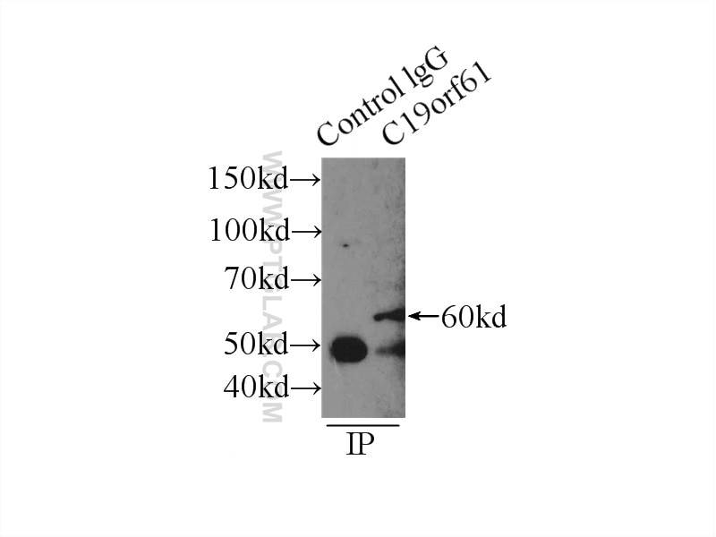 Immunoprecipitation (IP) experiment of HeLa cells using C19orf61 Polyclonal antibody (24797-1-AP)