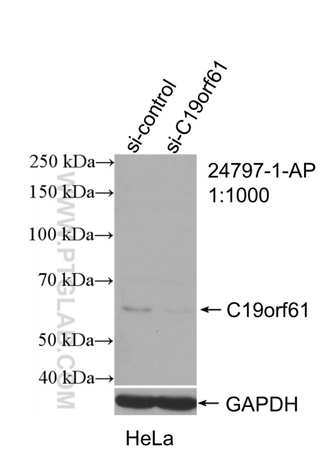 Western Blot (WB) analysis of HeLa cells using C19orf61 Polyclonal antibody (24797-1-AP)