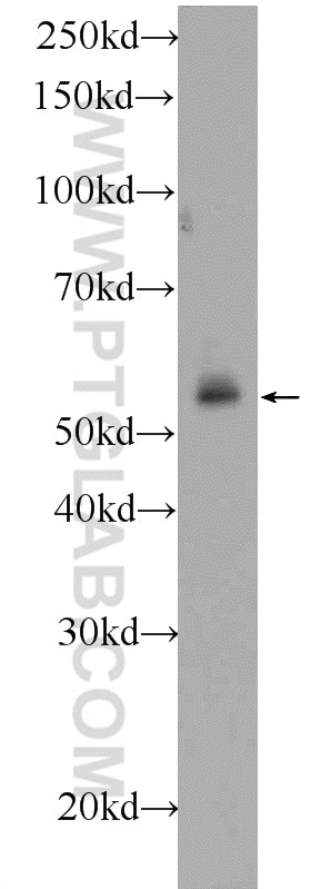 Western Blot (WB) analysis of HeLa cells using C19orf61 Polyclonal antibody (24797-1-AP)