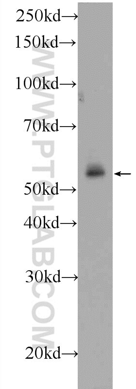 WB analysis of HeLa using 24797-1-AP