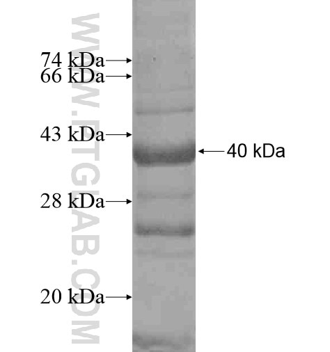 C19orf61 fusion protein Ag14965 SDS-PAGE