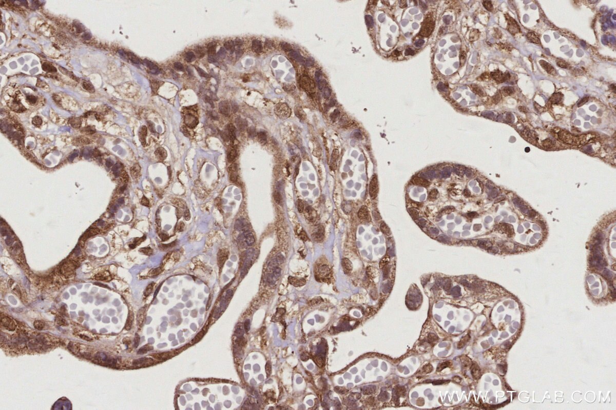 Immunohistochemistry (IHC) staining of human placenta tissue using MERIT40 Polyclonal antibody (27926-1-AP)