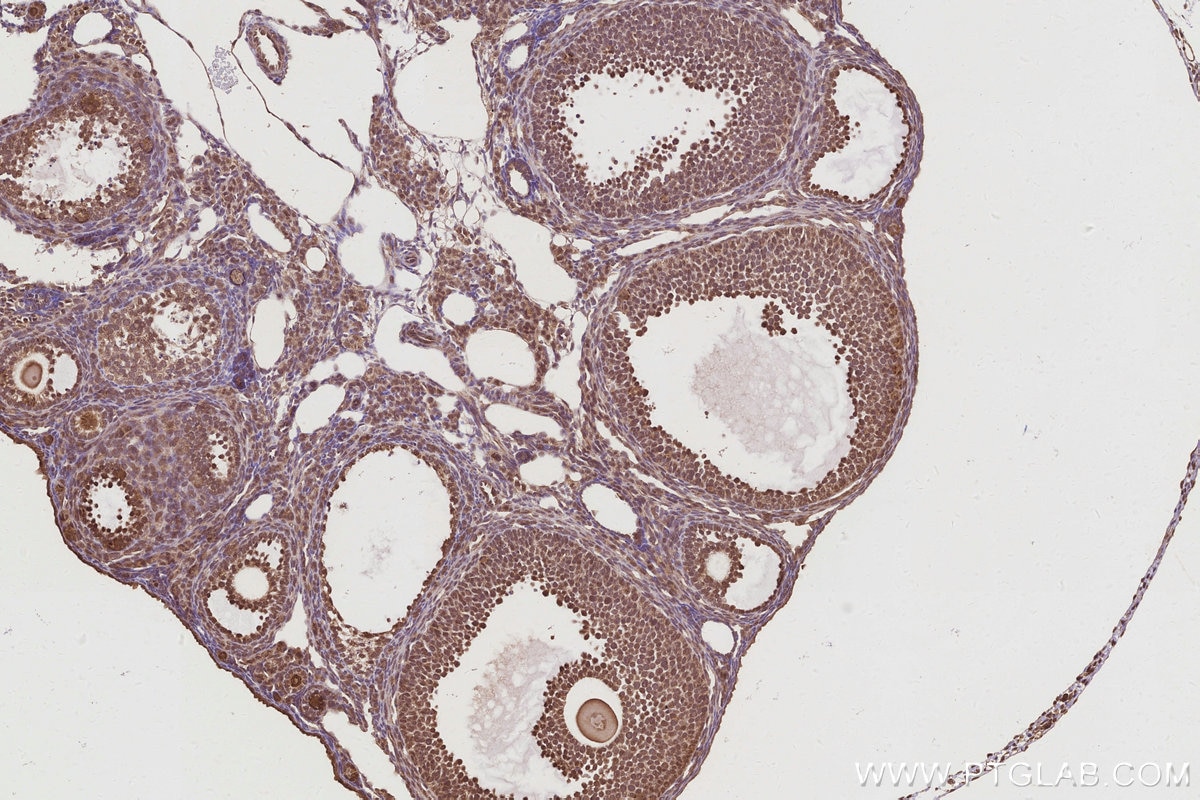 Immunohistochemistry (IHC) staining of mouse ovary tissue using MERIT40 Polyclonal antibody (27926-1-AP)