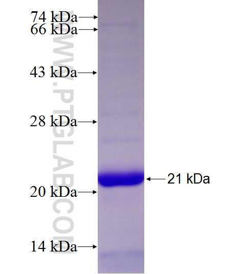 C19orf62 fusion protein Ag27424 SDS-PAGE