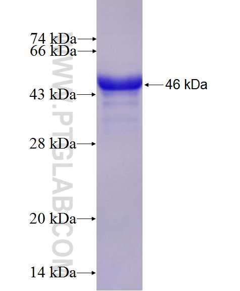 C19orf62 fusion protein Ag27459 SDS-PAGE