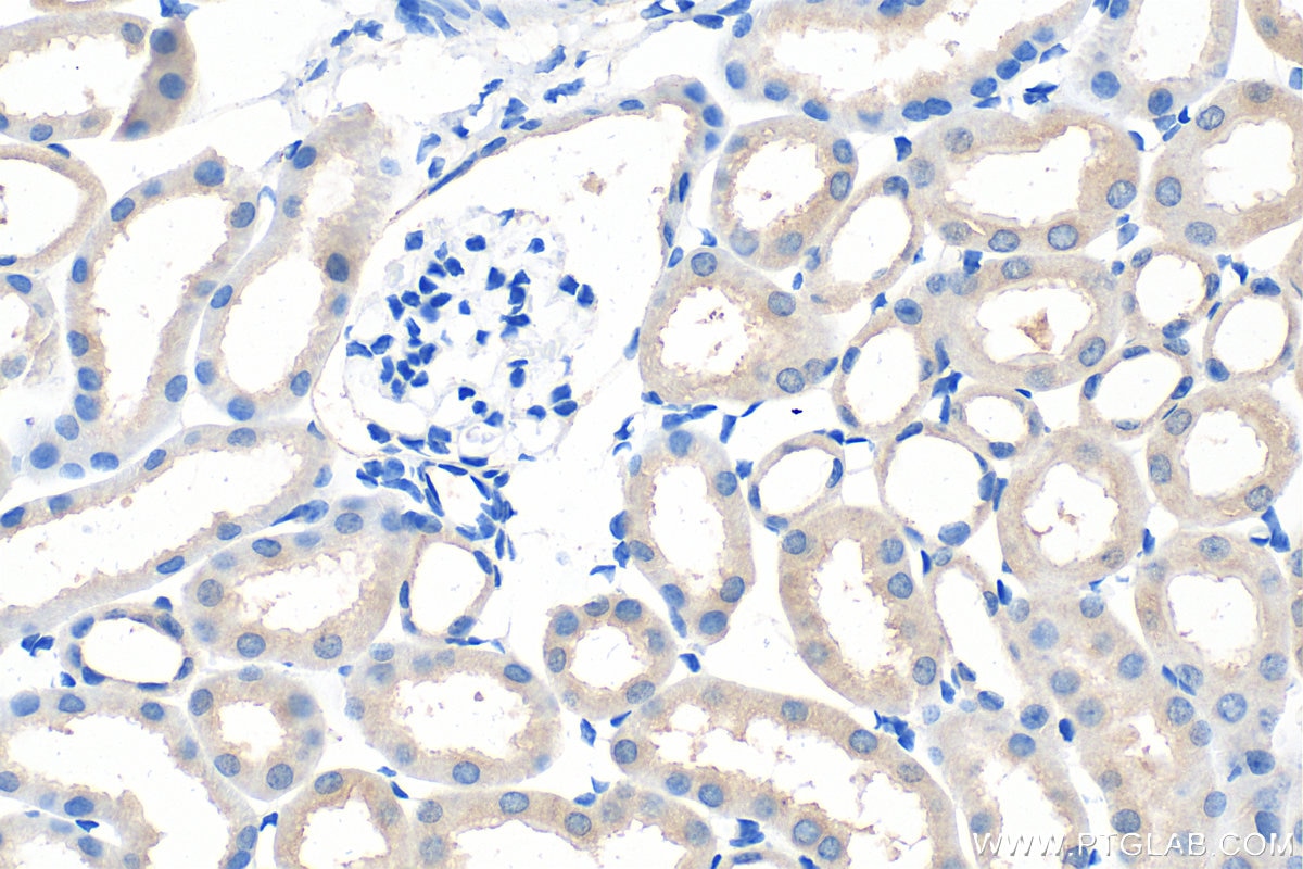 Immunohistochemistry (IHC) staining of mouse kidney tissue using C19orf63 Polyclonal antibody (30844-1-AP)