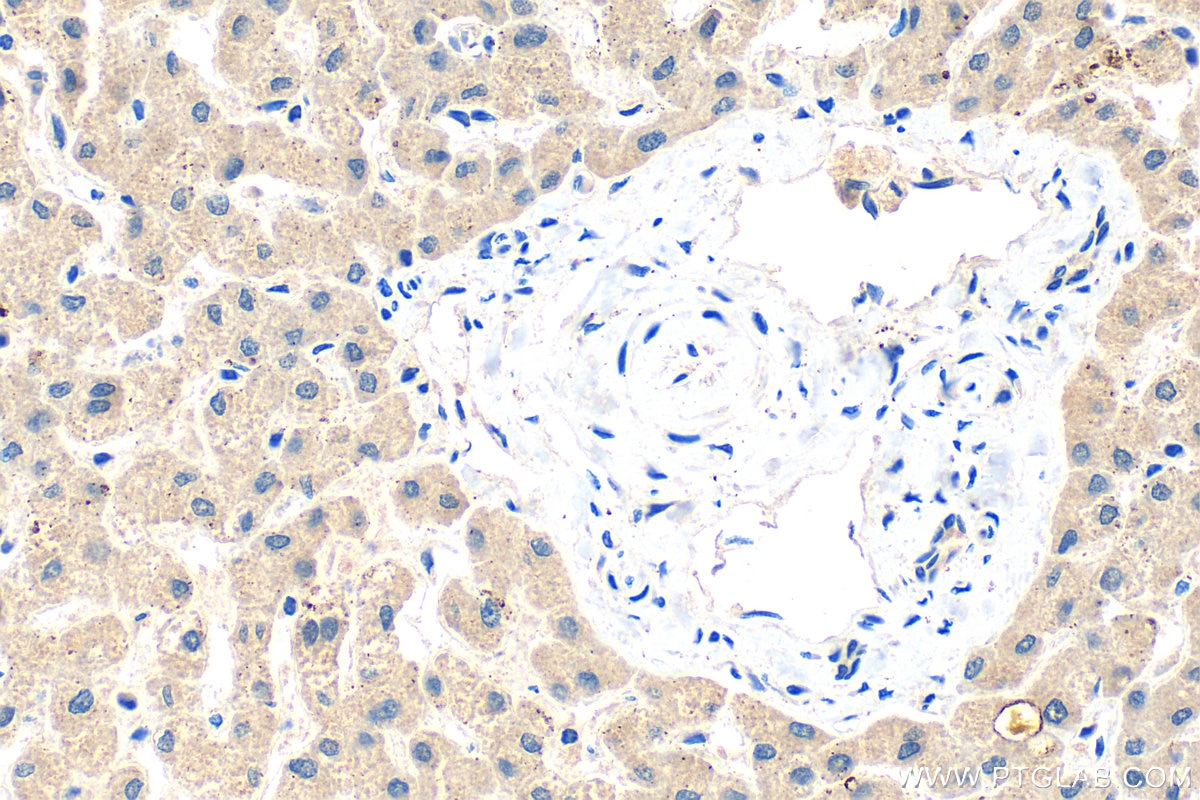 Immunohistochemistry (IHC) staining of human liver tissue using C19orf63 Polyclonal antibody (30844-1-AP)