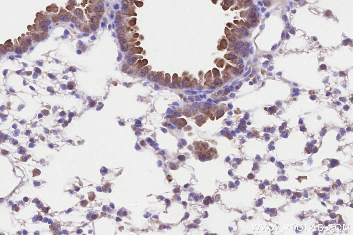 IHC staining of mouse lung using 30844-1-AP Immunohistochemistry (IHC) staining of mouse lung tissue using C19orf63 Polyclonal antibody (30844-1-AP)