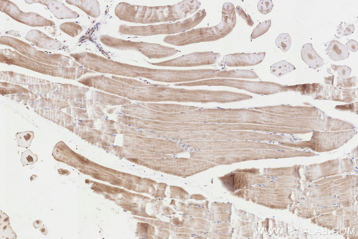 IHC staining of rat skeletal muscle using 30844-1-AP Immunohistochemistry (IHC) staining of rat skeletal muscle tissue using C19orf63 Polyclonal antibody (30844-1-AP)