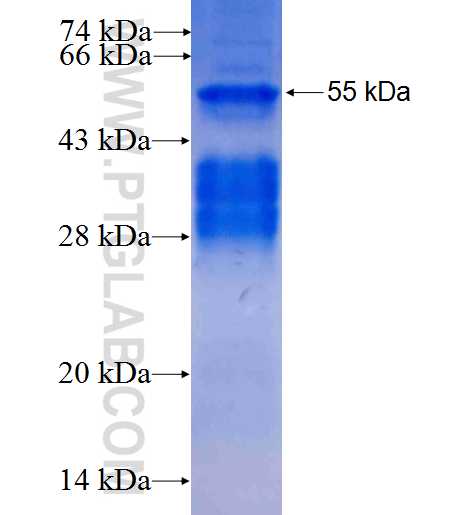 C19orf66 fusion protein Ag26838 SDS-PAGE