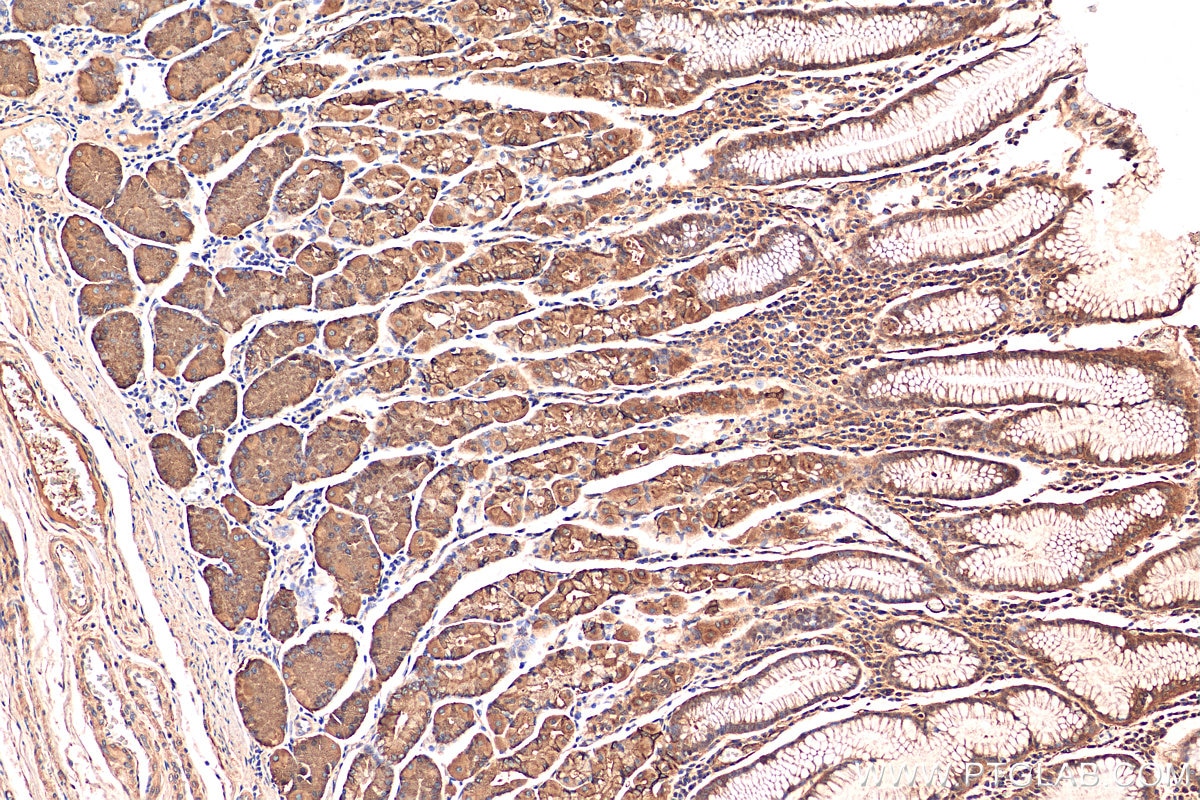 Immunohistochemistry (IHC) staining of human stomach tissue using C19orf70 Polyclonal antibody (25514-1-AP)