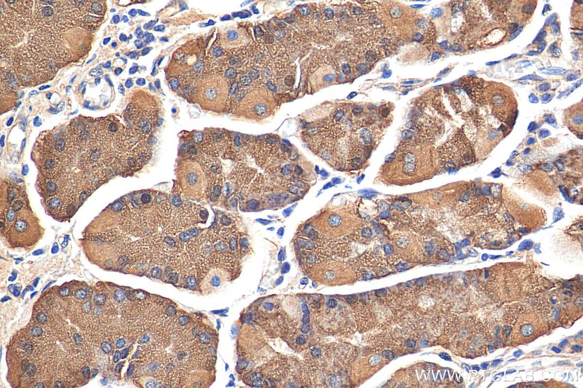 Immunohistochemistry (IHC) staining of human stomach tissue using C19orf70 Polyclonal antibody (25514-1-AP)
