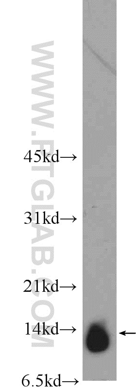 Western Blot (WB) analysis of mouse brain tissue using C19orf70 Polyclonal antibody (25514-1-AP)