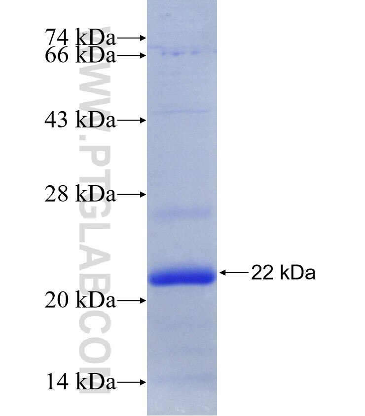 C19orf72 fusion protein Ag30318 SDS-PAGE