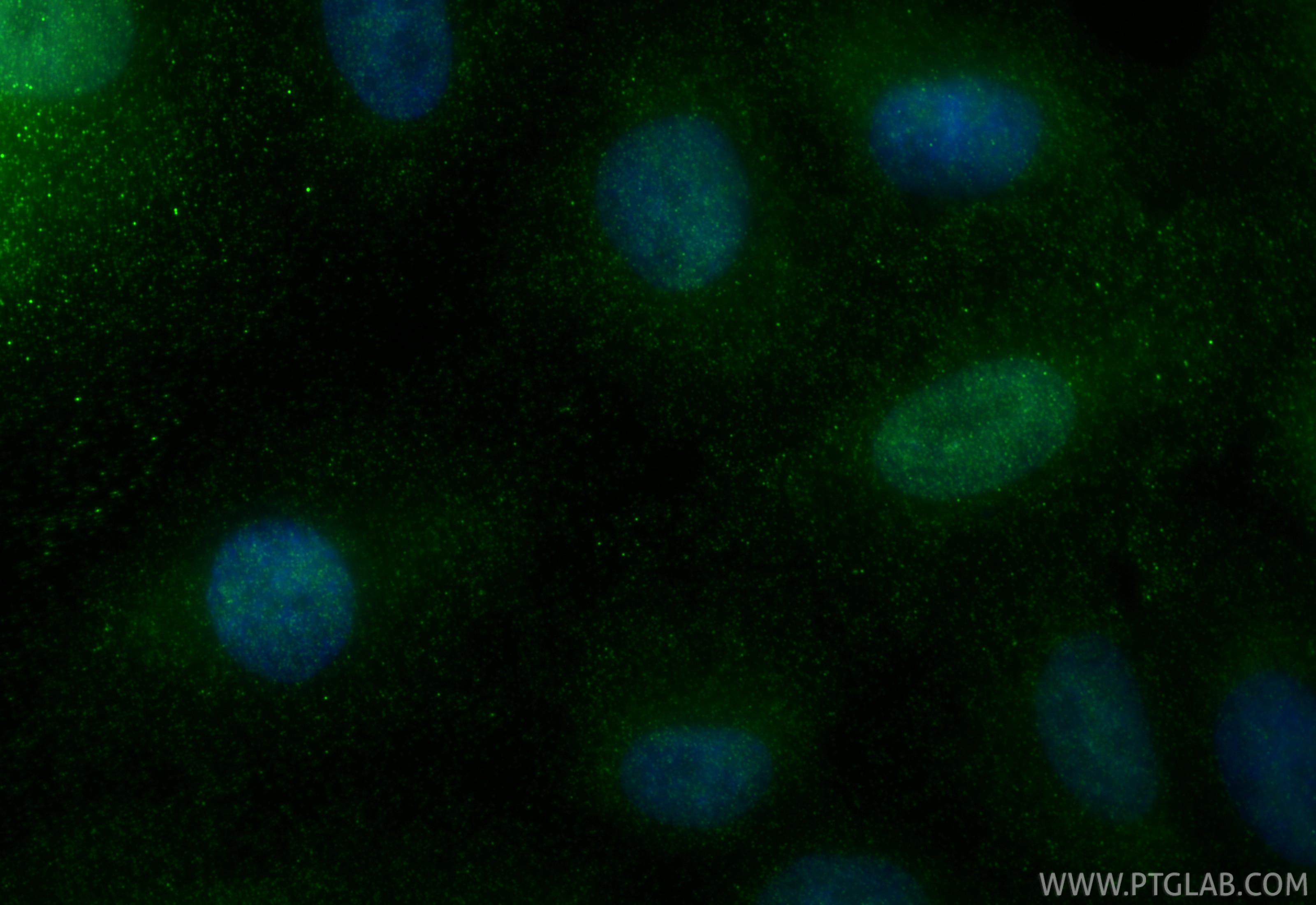 Immunofluorescence (IF) / fluorescent staining of A549 cells using C19orf73 Polyclonal antibody (24856-1-AP)