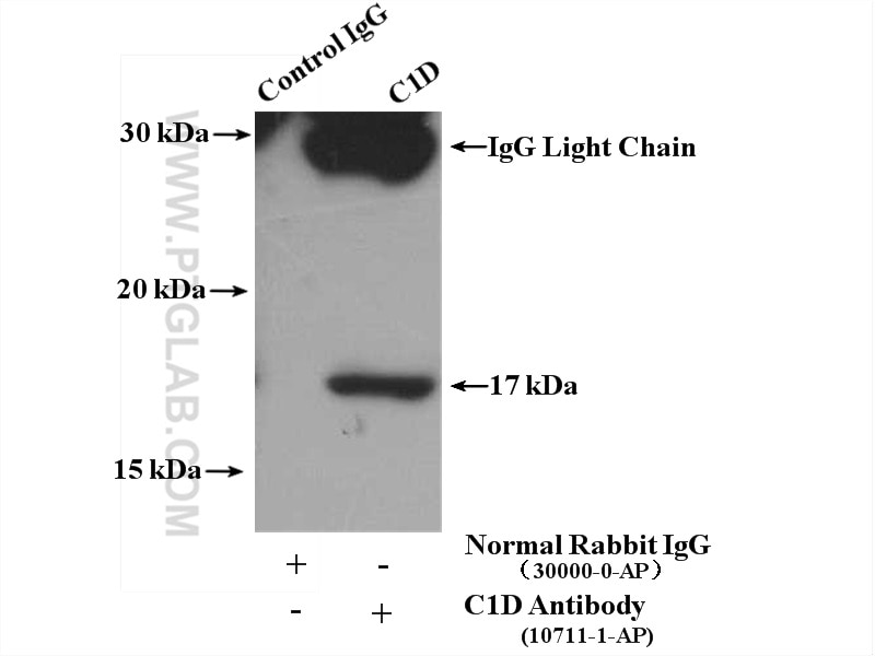 Immunoprecipitation (IP) experiment of DU 145 cells using C1D Polyclonal antibody (10711-1-AP)