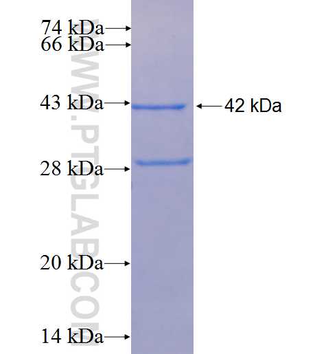 C1D fusion protein Ag1121 SDS-PAGE