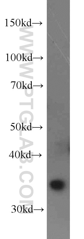 Western Blot (WB) analysis of HeLa cells using COSMC Polyclonal antibody (19254-1-AP)