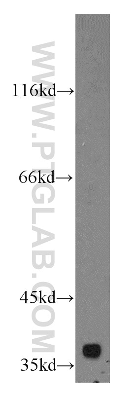 Western Blot (WB) analysis of HeLa cells using COSMC Polyclonal antibody (19254-1-AP)