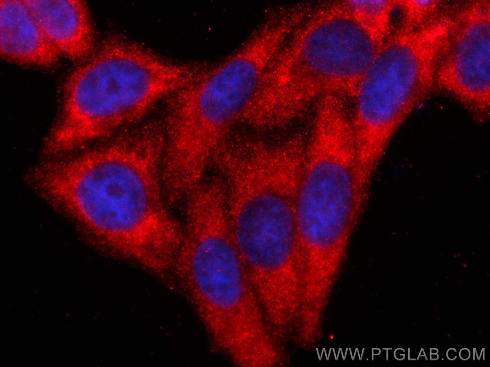 Immunofluorescence (IF) / fluorescent staining of HepG2 cells using C1QA Polyclonal antibody (11602-1-AP)