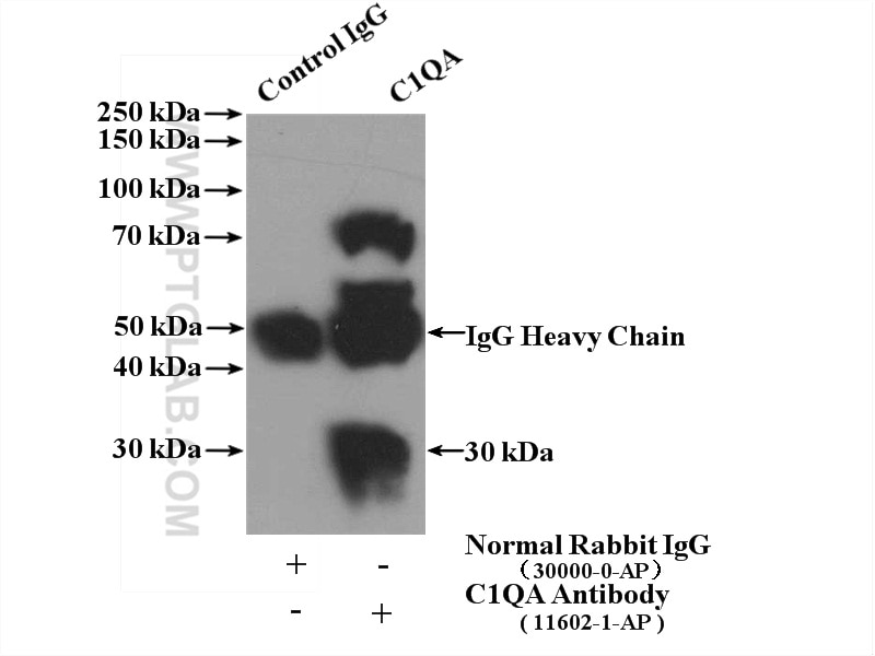 Immunoprecipitation (IP) experiment of mouse liver tissue using C1qA Polyclonal antibody (11602-1-AP)
