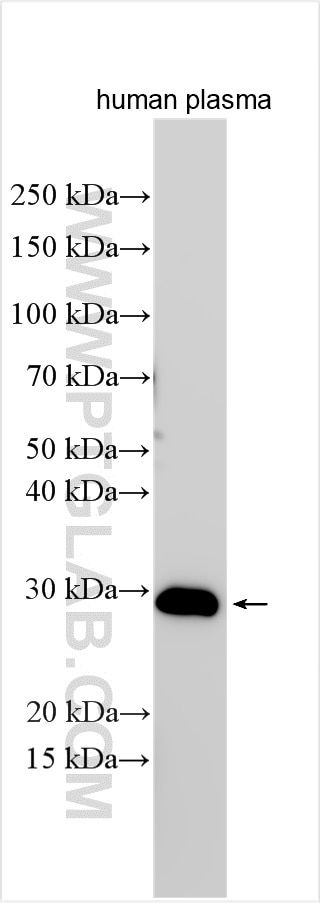 WB analysis of human plasma using 11602-1-AP