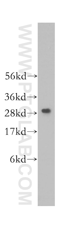 Western Blot (WB) analysis of human liver tissue using C1qA Polyclonal antibody (11602-1-AP)