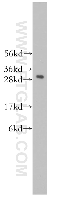 Western Blot (WB) analysis of human heart tissue using C1qA Polyclonal antibody (11602-1-AP)