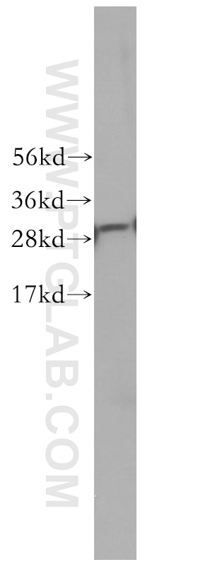 Western Blot (WB) analysis of human lung tissue using C1qA Polyclonal antibody (11602-1-AP)