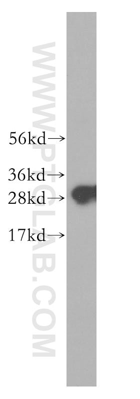 Western Blot (WB) analysis of human colon tissue using C1qA Polyclonal antibody (11602-1-AP)