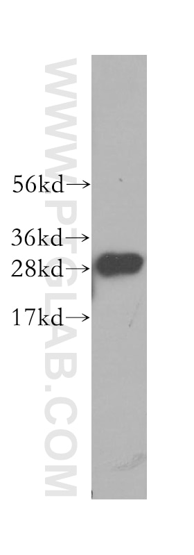 Western Blot (WB) analysis of human spleen tissue using C1qA Polyclonal antibody (11602-1-AP)