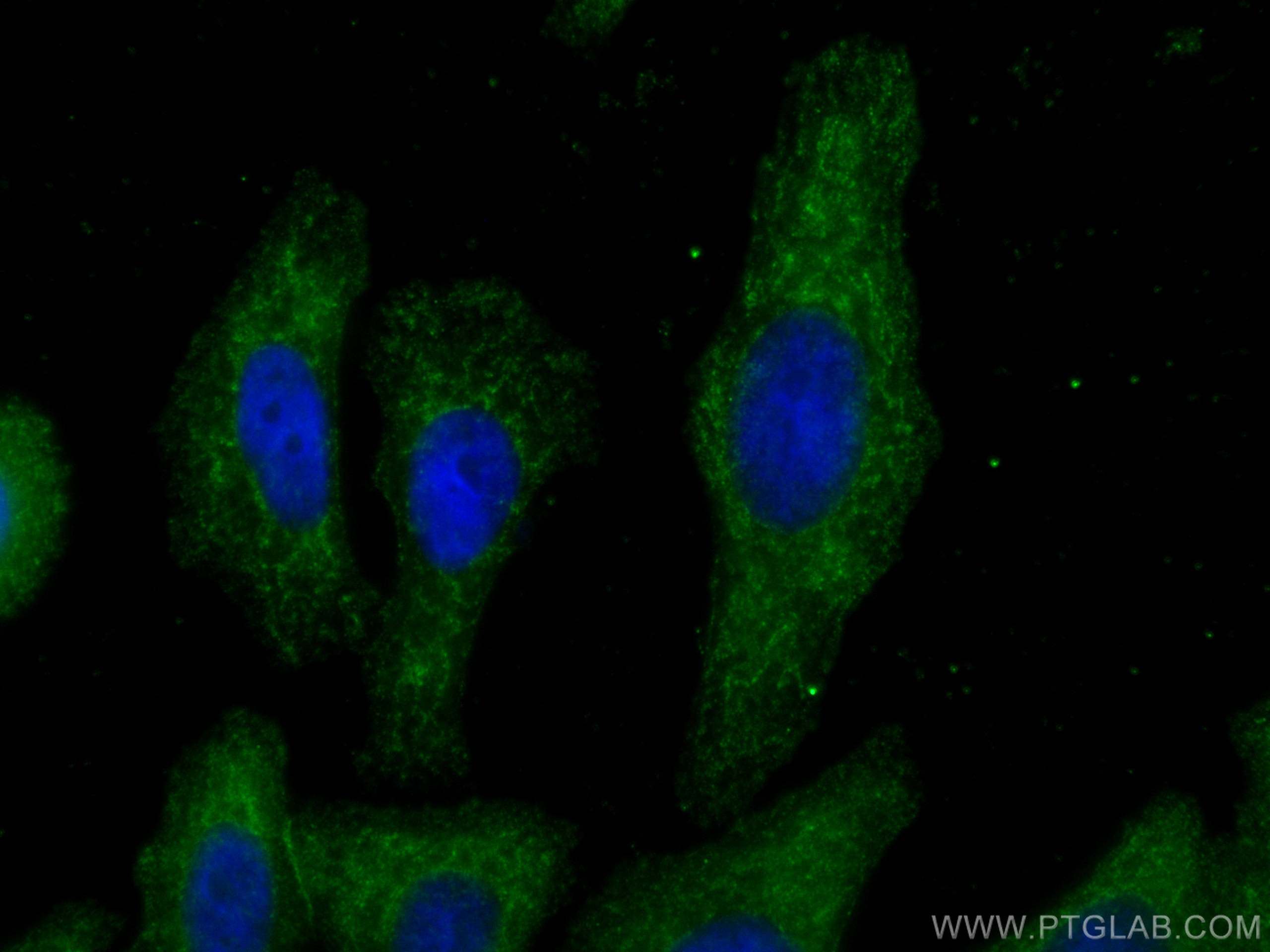 Immunofluorescence (IF) / fluorescent staining of HepG2 cells using C1QA Monoclonal antibody (67063-1-Ig)