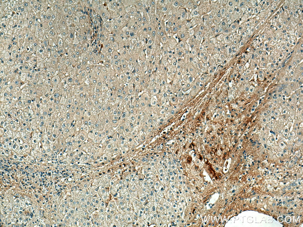 Immunohistochemistry (IHC) staining of human liver tissue using C1QA Monoclonal antibody (67063-1-Ig)