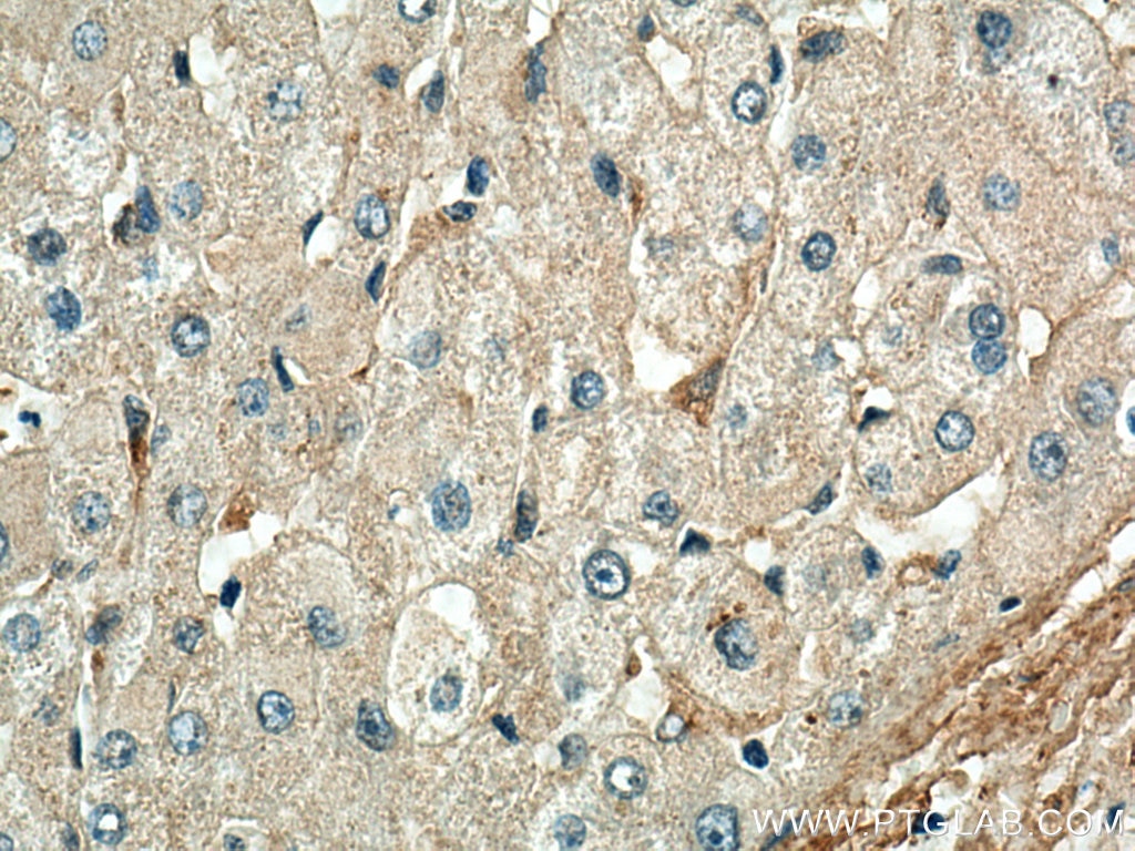 Immunohistochemistry (IHC) staining of human liver tissue using C1QA Monoclonal antibody (67063-1-Ig)