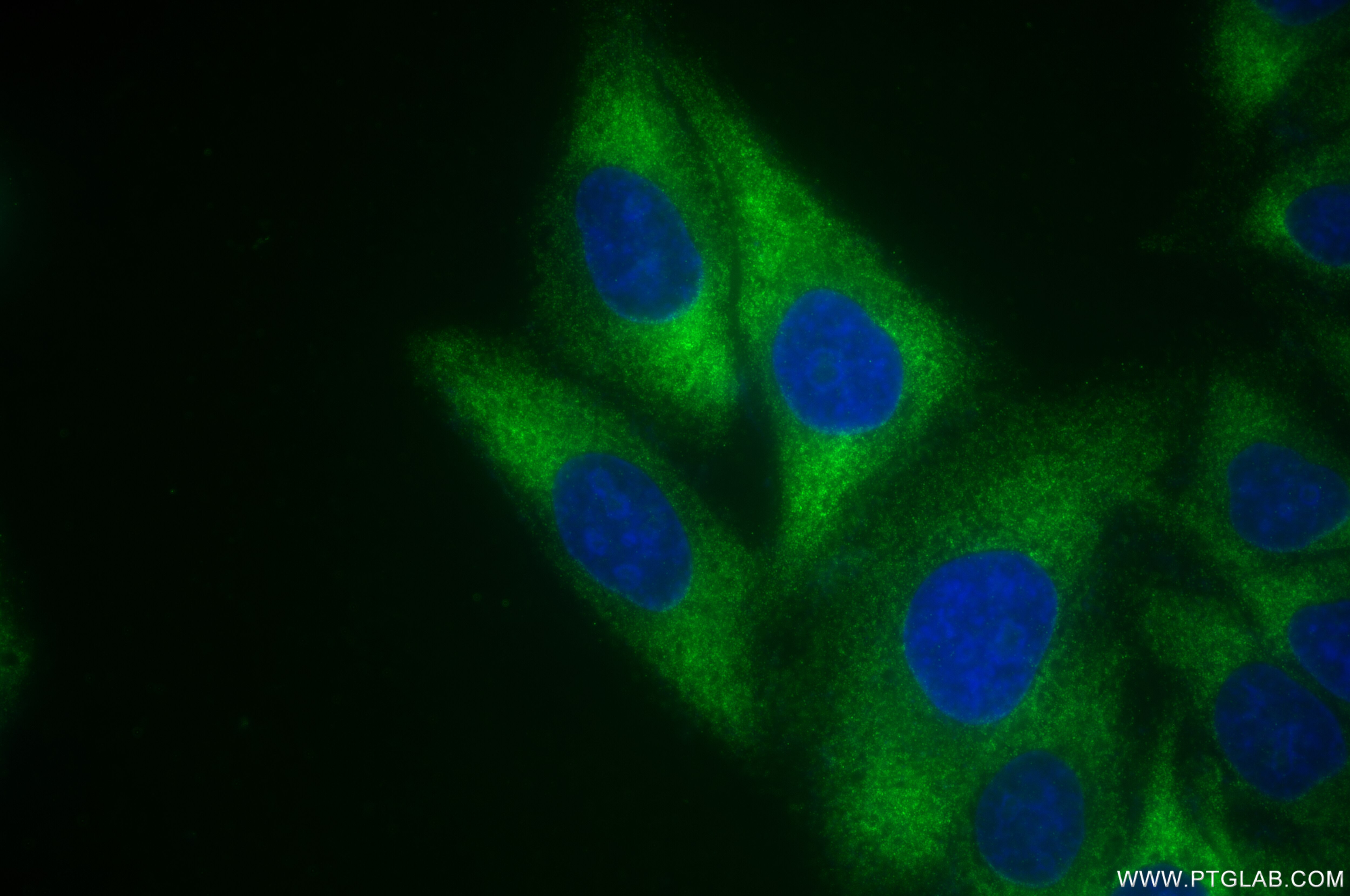 Immunofluorescence (IF) / fluorescent staining of HepG2 cells using C1QA Recombinant antibody (85719-4-RR)