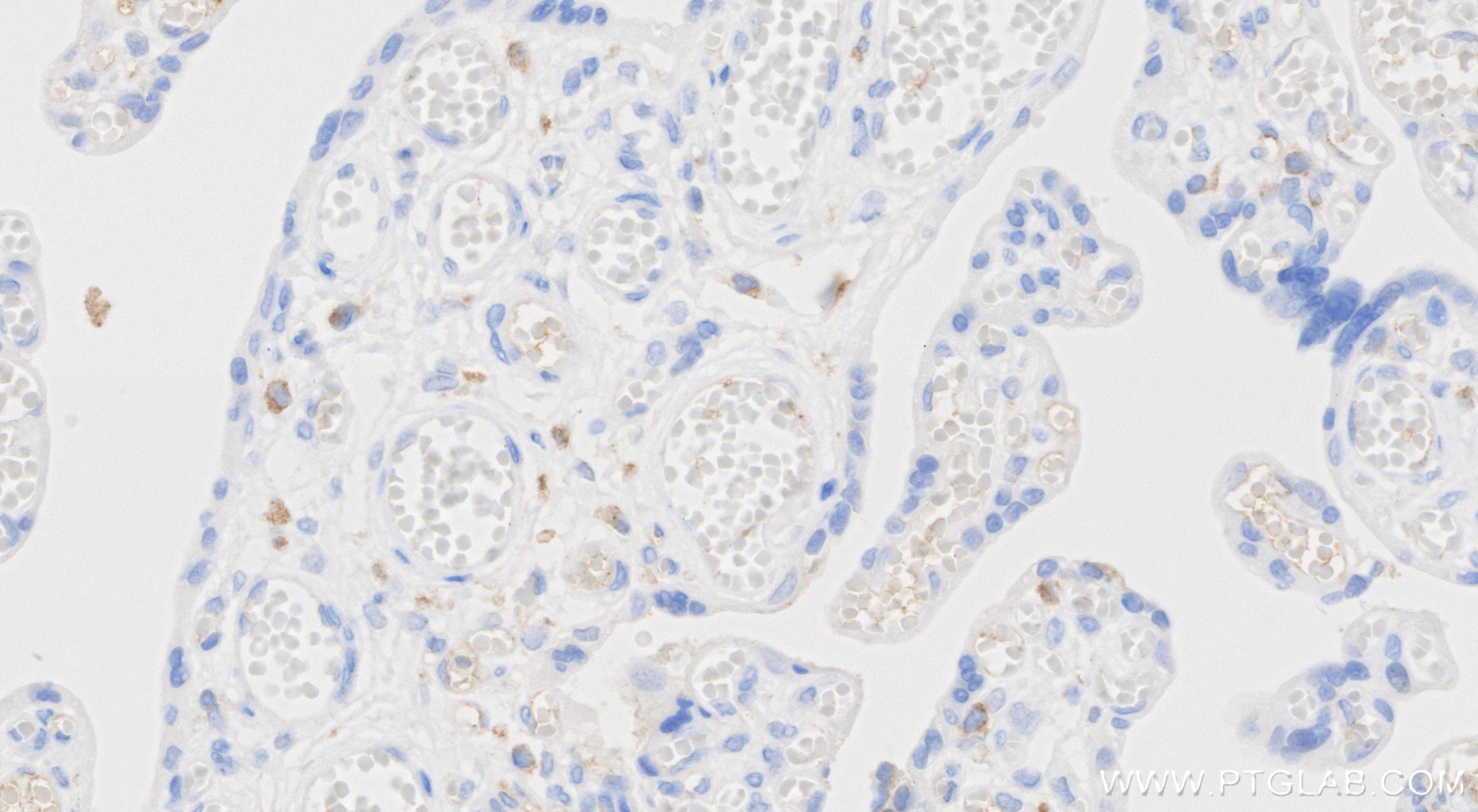 Immunohistochemistry (IHC) staining of human placenta tissue using C1QA Recombinant monoclonal antibody (85719-5-RR)