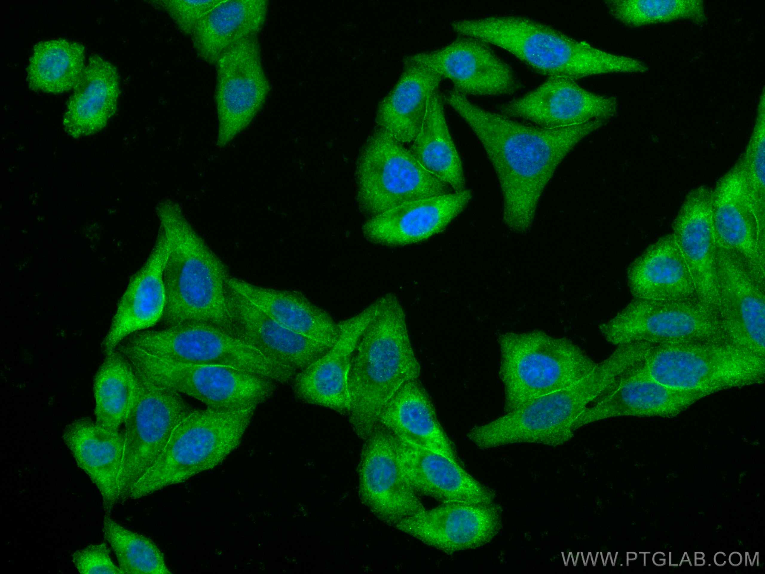 Immunofluorescence (IF) / fluorescent staining of HepG2 cells using CoraLite® Plus 488-conjugated C1QA Monoclonal anti (CL488-67063)