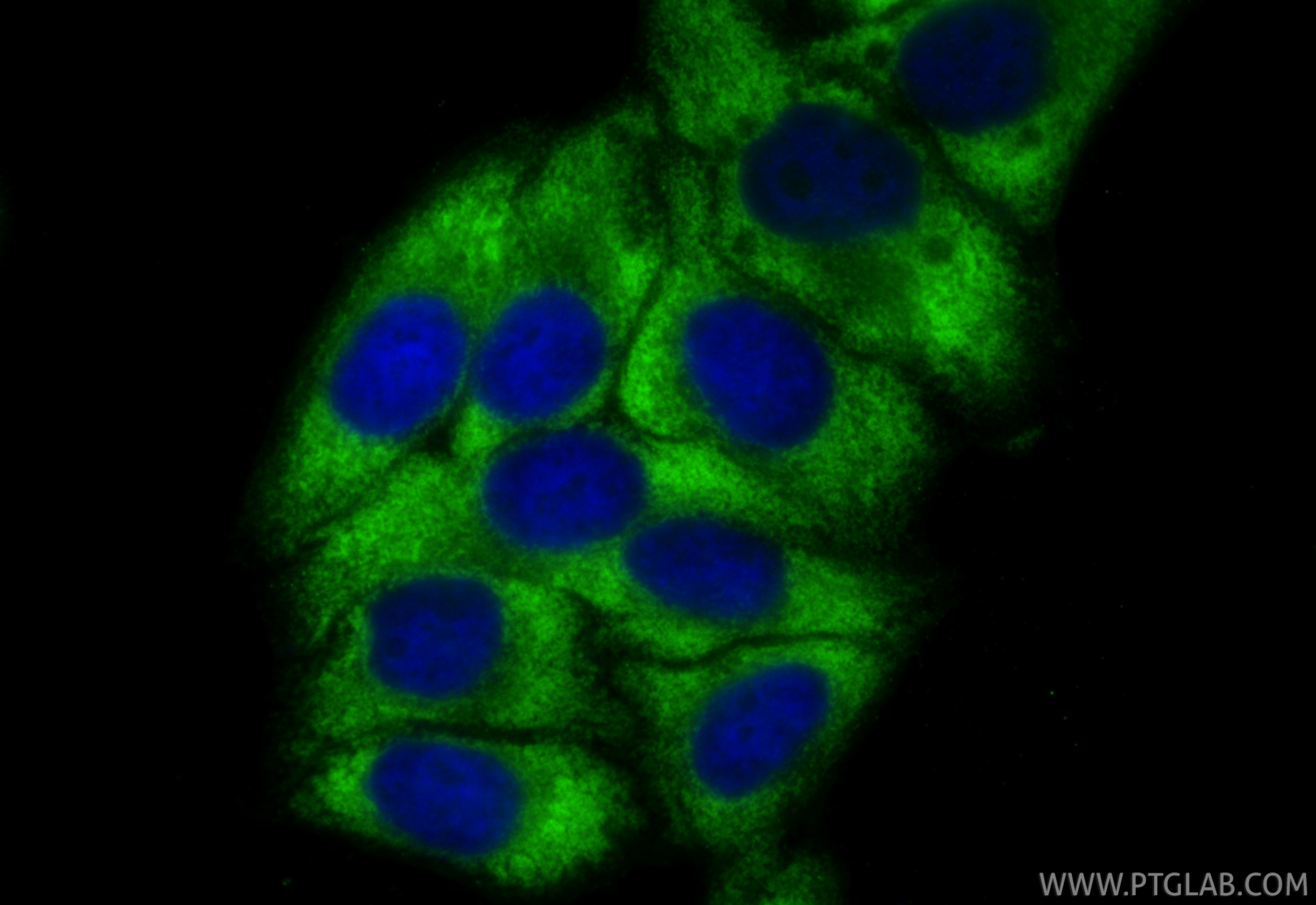 Immunofluorescence (IF) / fluorescent staining of HepG2 cells using CoraLite® Plus 488-conjugated C1QA Recombinant mon (CL488-85719-4)