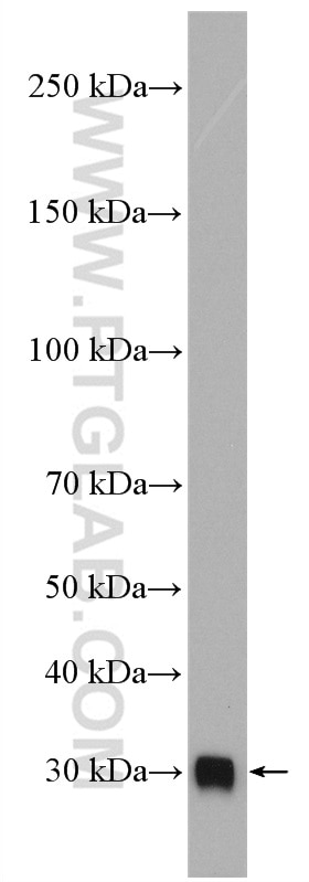 Western Blot (WB) analysis of human plasma using C1qB Polyclonal antibody (16919-1-AP)