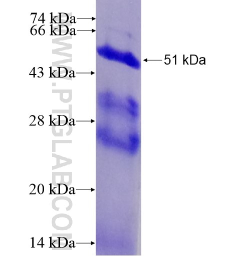C1QB fusion protein Ag10225 SDS-PAGE