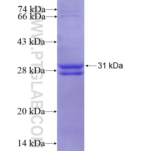 C1QB fusion protein Ag10622 SDS-PAGE