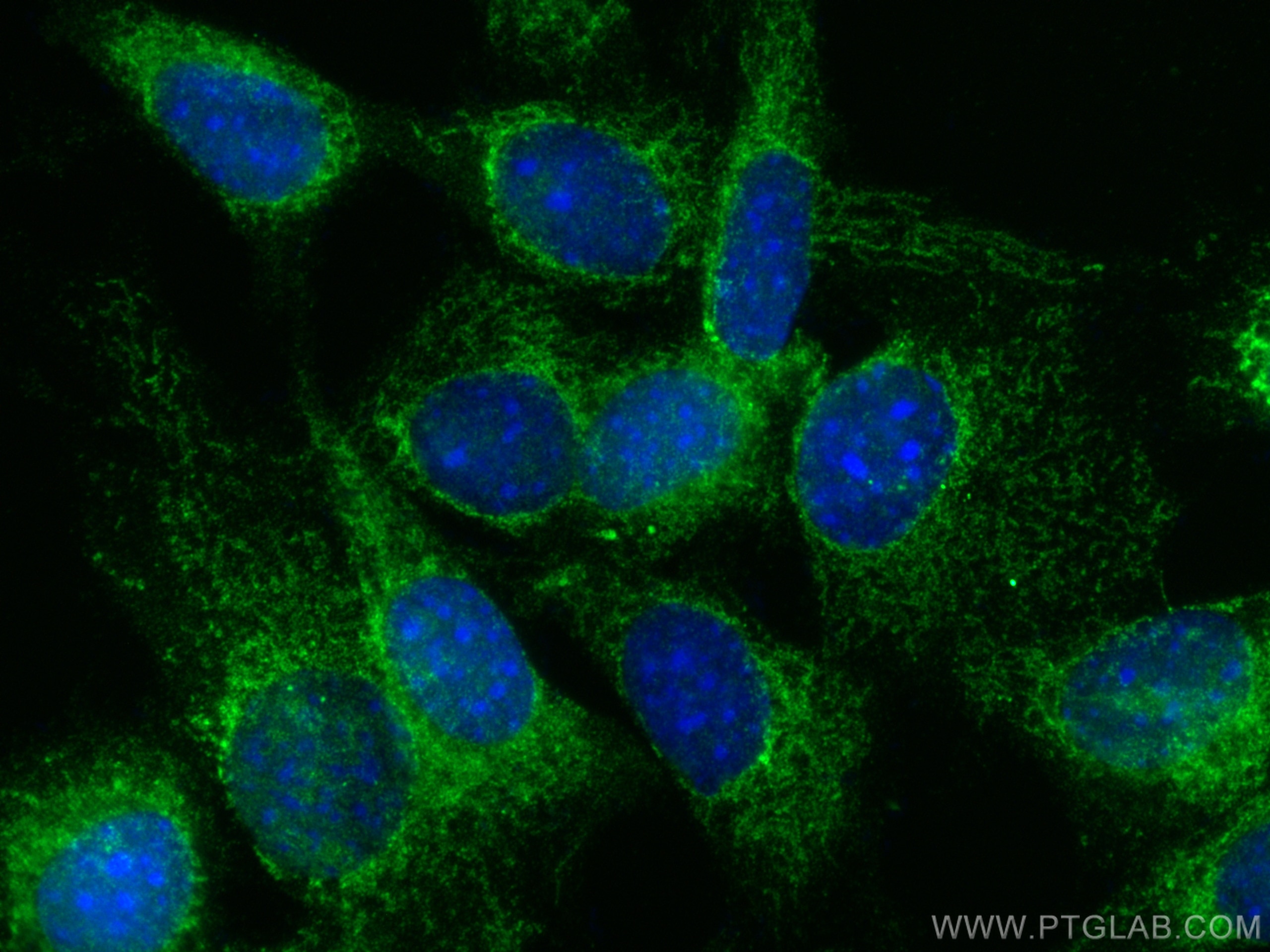 IF Staining of NIH/3T3 using 24474-1-AP