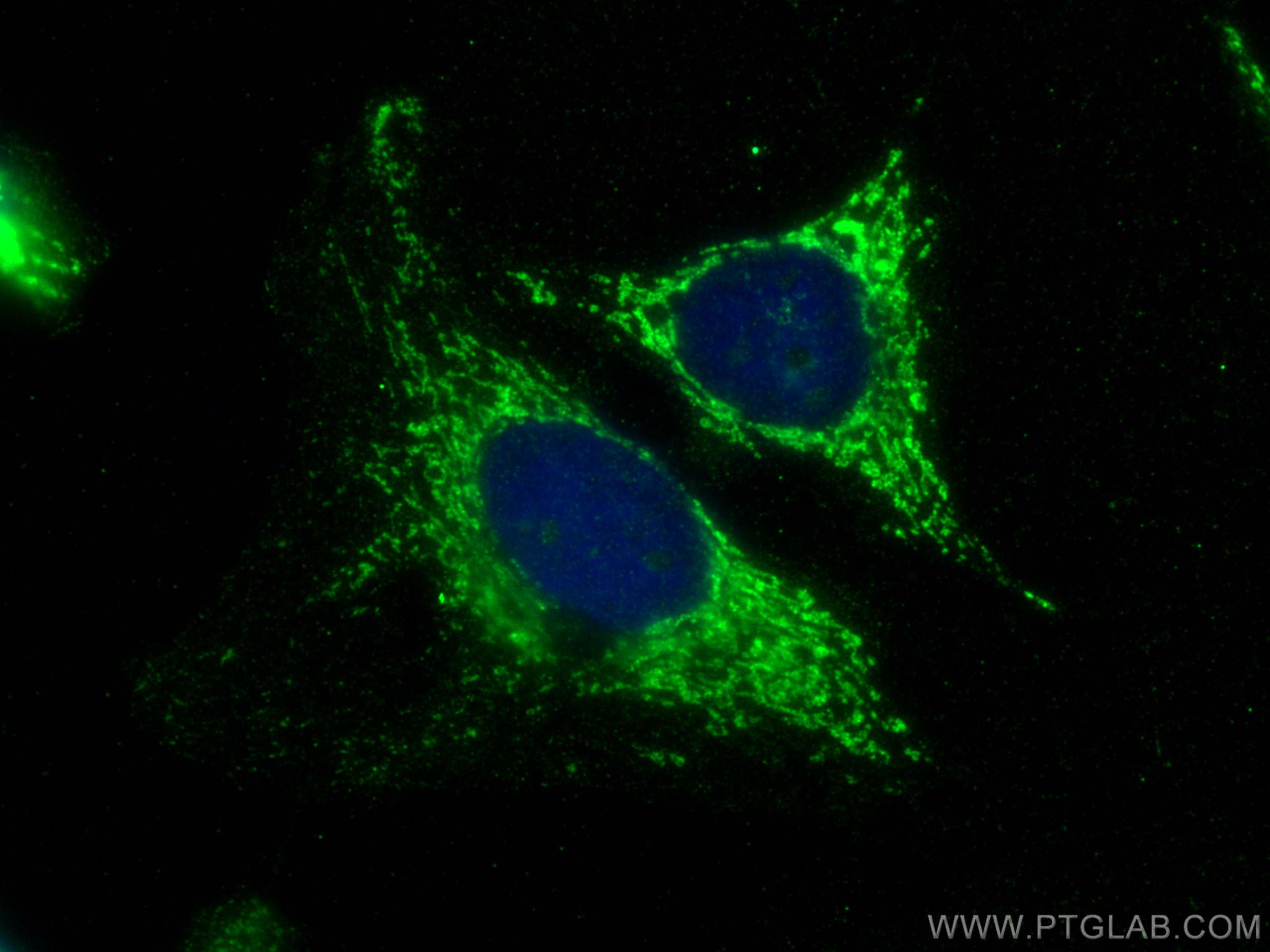Immunofluorescence (IF) / fluorescent staining of HeLa cells using C1QBP Monoclonal antibody (68084-1-Ig)