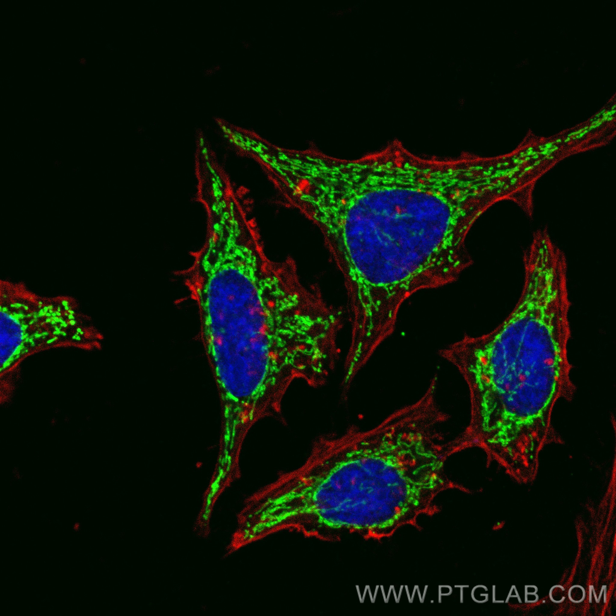 Immunofluorescence (IF) / fluorescent staining of HeLa cells using C1QBP Recombinant antibody (80490-1-RR)
