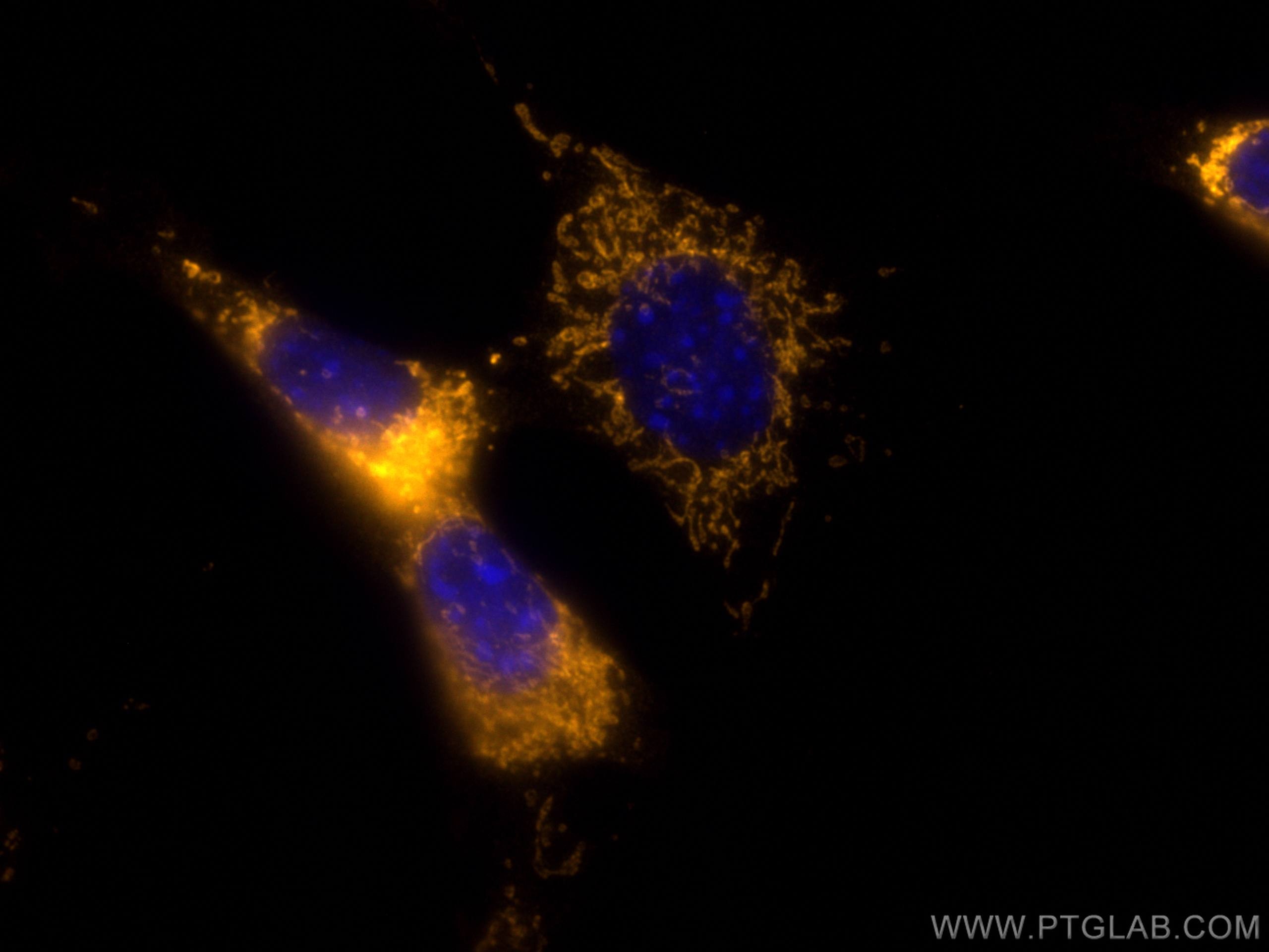 Immunofluorescence (IF) / fluorescent staining of NIH/3T3 cells using CoraLite®555-conjugated C1QBP Polyclonal antibody (CL555-24474)