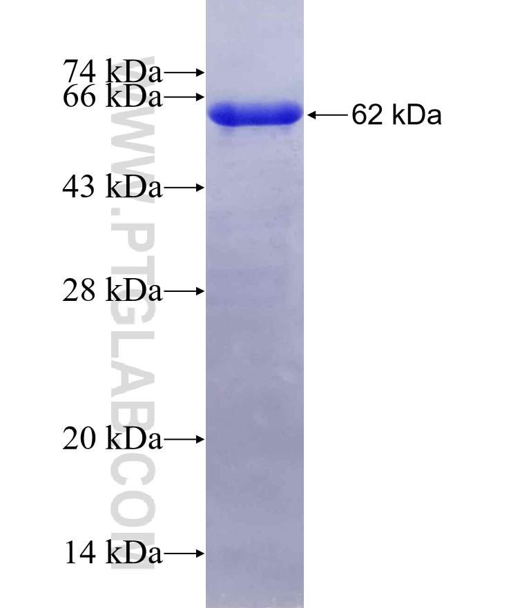 C1QBP fusion protein Ag19773 SDS-PAGE